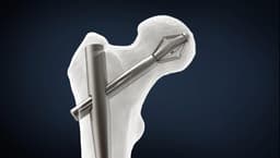 X-Bolt Orthopedics logo